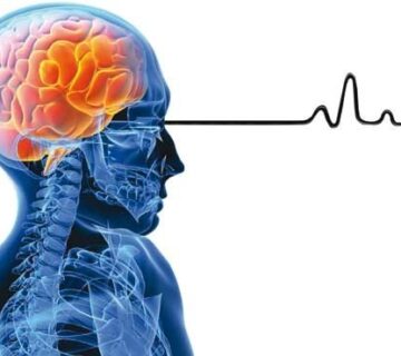 فراموشی پس از ضربه مغزی