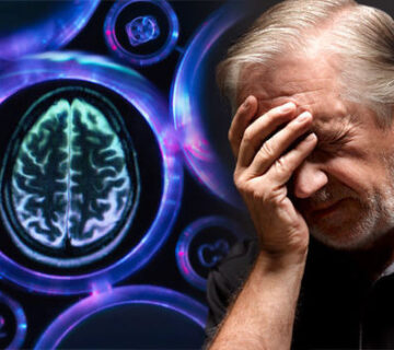 درمان دمانس در اصفهان