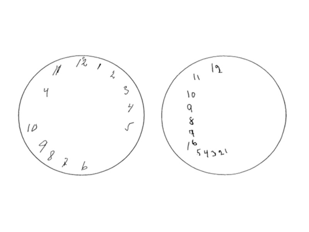 تست آلزایمر اصفهان