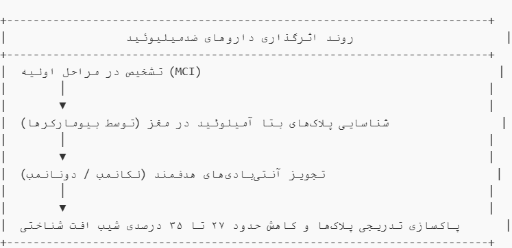 روش‌های جدید درمان آلزایمر؛ بررسی داروها و روش‌های نوین